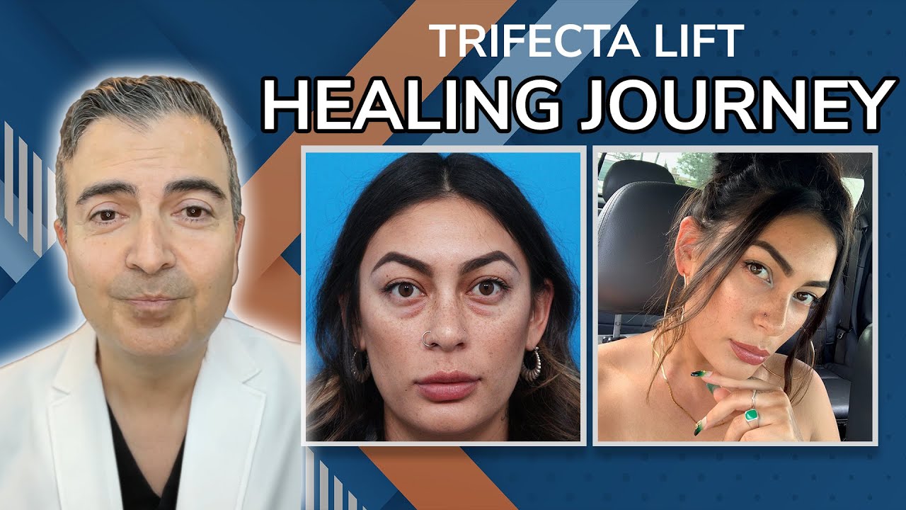 Healing After Trifecta Lift With Dr. Kami Parsa