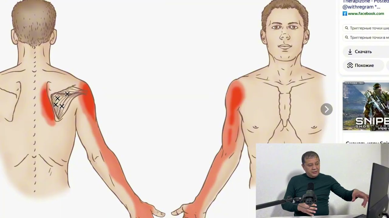 Елка бугими огриклари ва мушак огрикларини бир-биридан фарки 