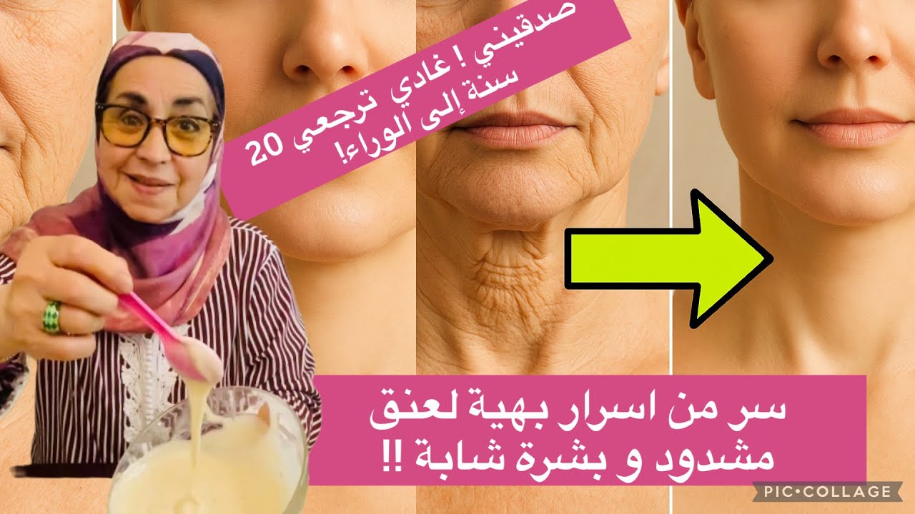 “وصفة خارقة لرقبة مشدودة وتخلي تجاعيدك تختفي رجعي شبابك وخلي الناس كلها تندهش!