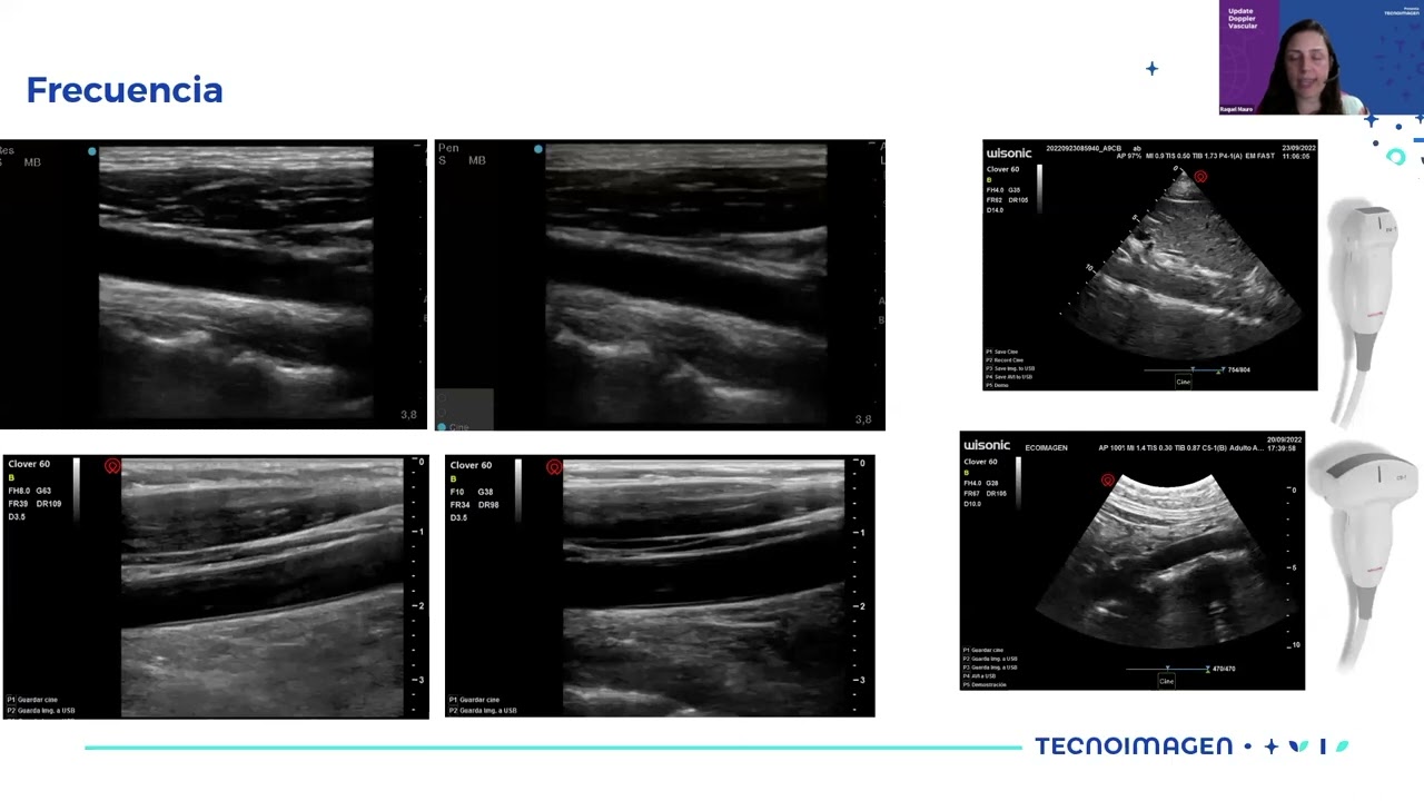 Clase 1 - Update Doppler Vascular
