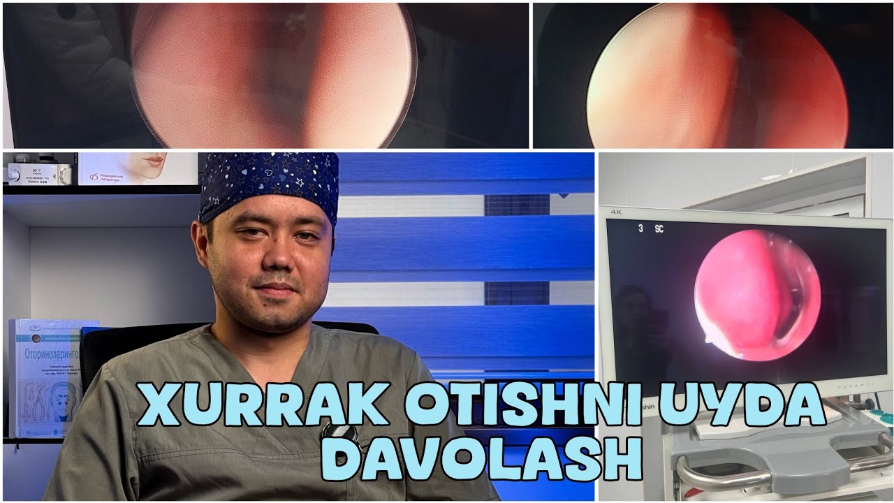 Xurrak otishni uy sharoitida bepul davolash usullari va bolalar xurragini kelib chiqish sabablari