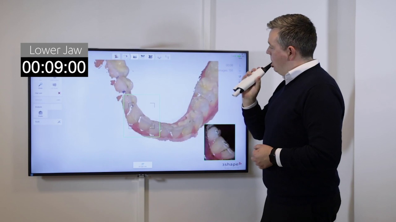 3Shape's MORTEN RYDE DEMONSTRATES THE NEW 3Shape TRIOS 4