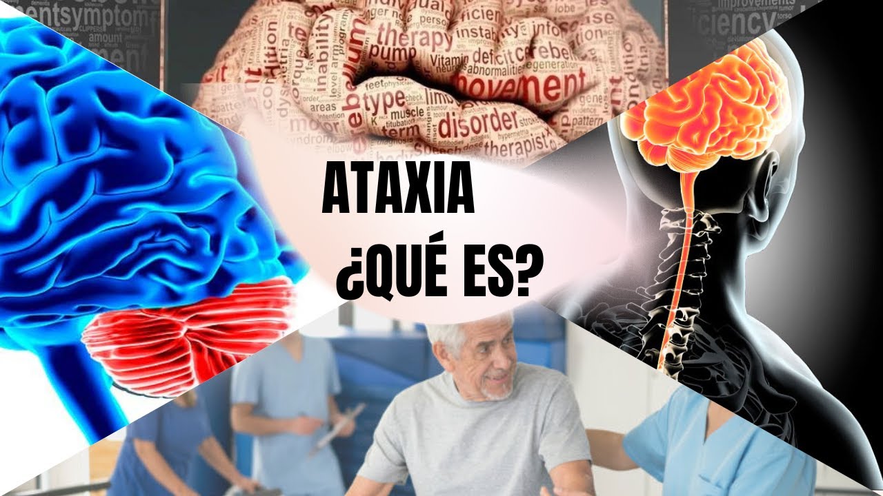 Las ataxias / causas / tratamiento.