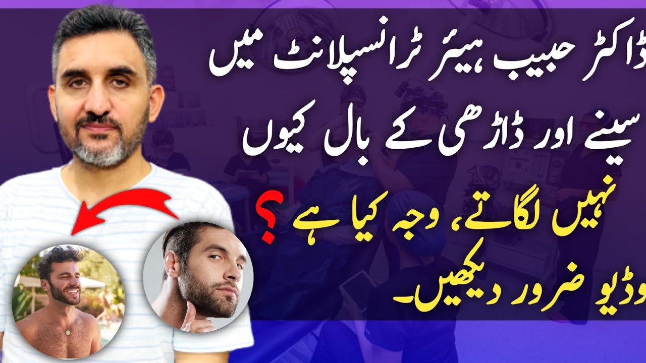 Why Dr. Habib Avoids Chest & Beard Hair in Hair Transplants?