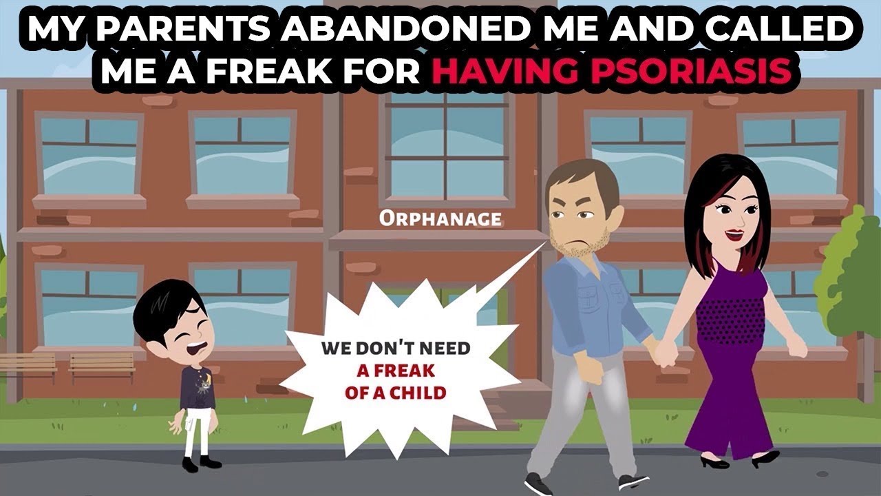 My parents abandoned me and called me a freak for having psoriasis
