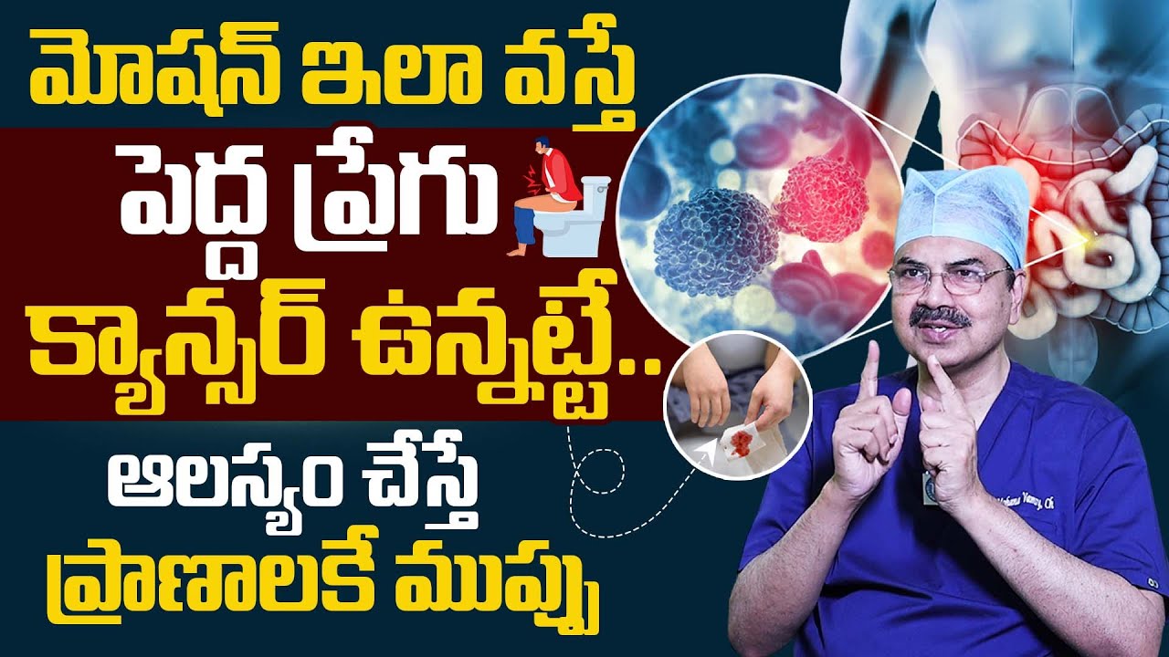 పెద్దప్రేగు క్యాన్సర్ లక్షణాలు | Dr. Mohana Vamsy About Colon Cancers | Cancer Symptoms | iDream