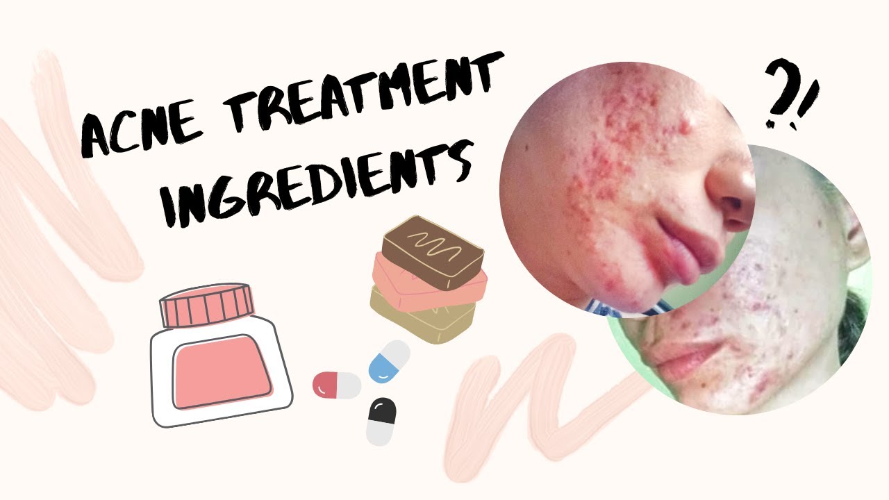 Acne Treatment Ingredients (OTC, prescription, natural)