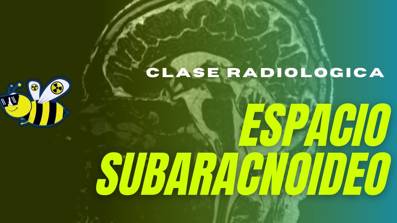 ⚠️⚠️ESPACIO SUBARACNOIDEO⚠️⚠️