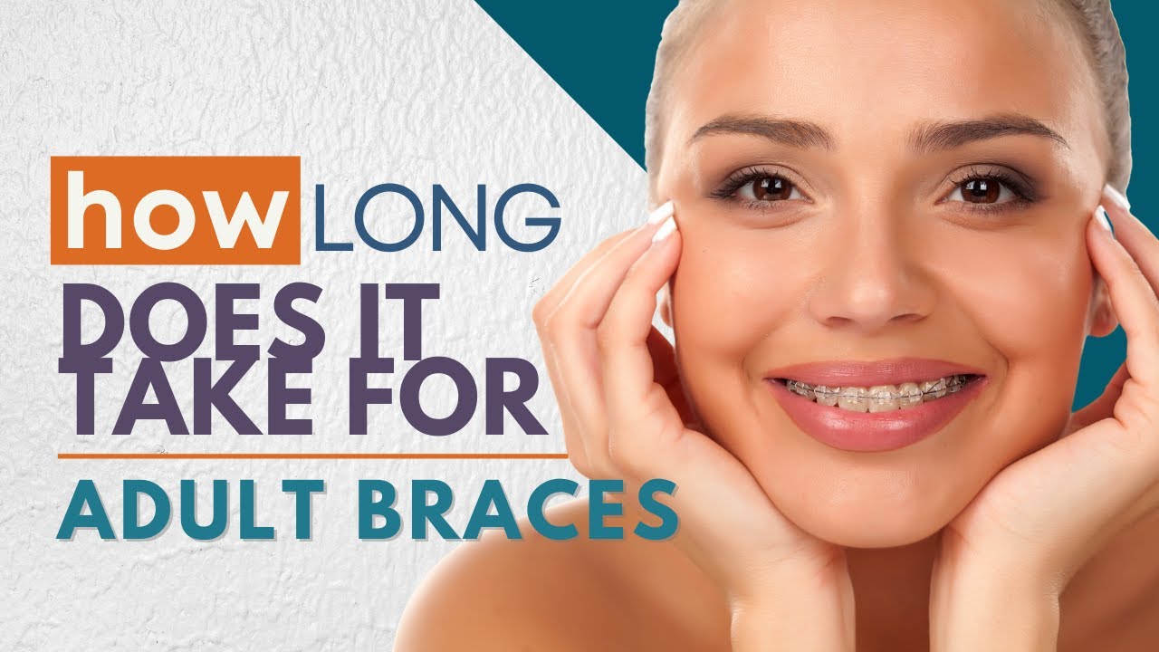 How Long do ADULT BRACES Take? | Do Braces work for Adults?