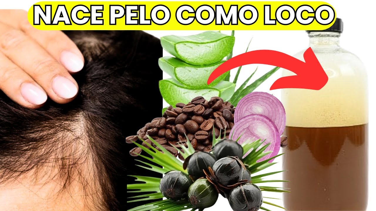 MEZCLA ESTO EN TU SHAMPOO Y TU CABELLO NO PARARÁ DE CRECER DETÉN LA CAÍDA DEL CABELLO Y CALVICIE  😱
