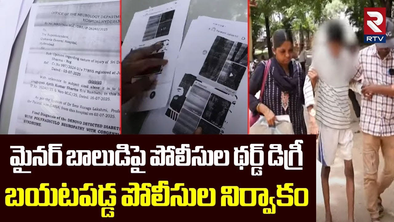 ప్రూఫ్ లతో అడ్డంగా బుక్కైన పోలీసులు .. | Police Third Degree On Minor Boy | CM Revanth Reddy | RTV