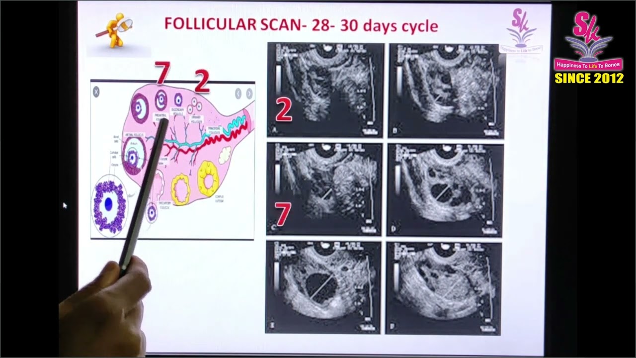 Episode 1: Natural Pregnancy - Understanding from Conception to process and reasons for failure