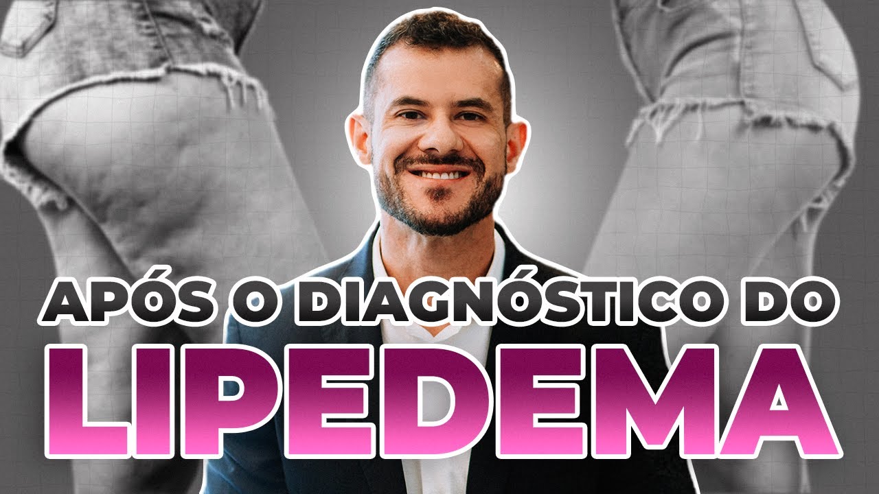 Recebi o diagn&oacute;stico de lipedema - O QUE FAZER? [Tratamento Para Lipedema]