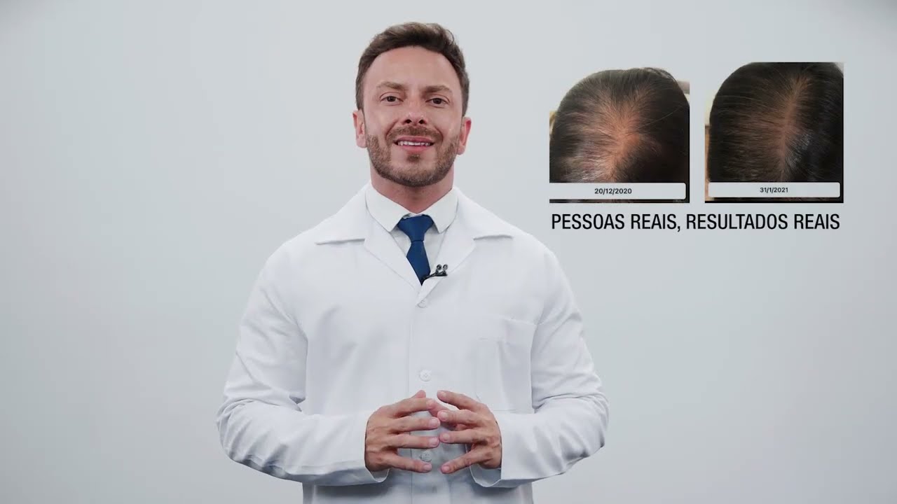 Hairegen: Tecnologia Contra a Queda de Cabelo Genética Sem Remédios | Portfólio Fusion Studio