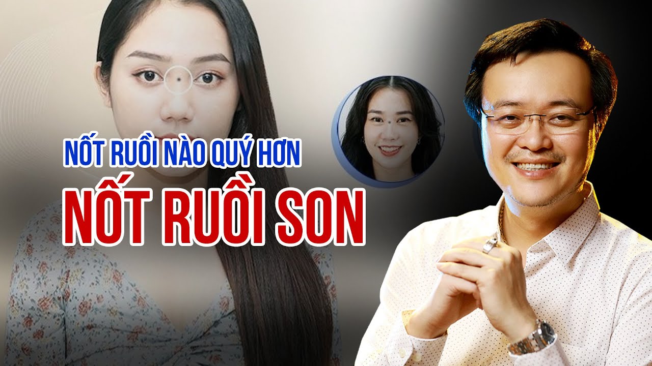 Nốt Ruồi Nào Quý Hơn Nốt Ruồi Son? | Nốt Ruồi Nào Không Được Tẩy Bỏ | Phong Thủy Tam Nguyên