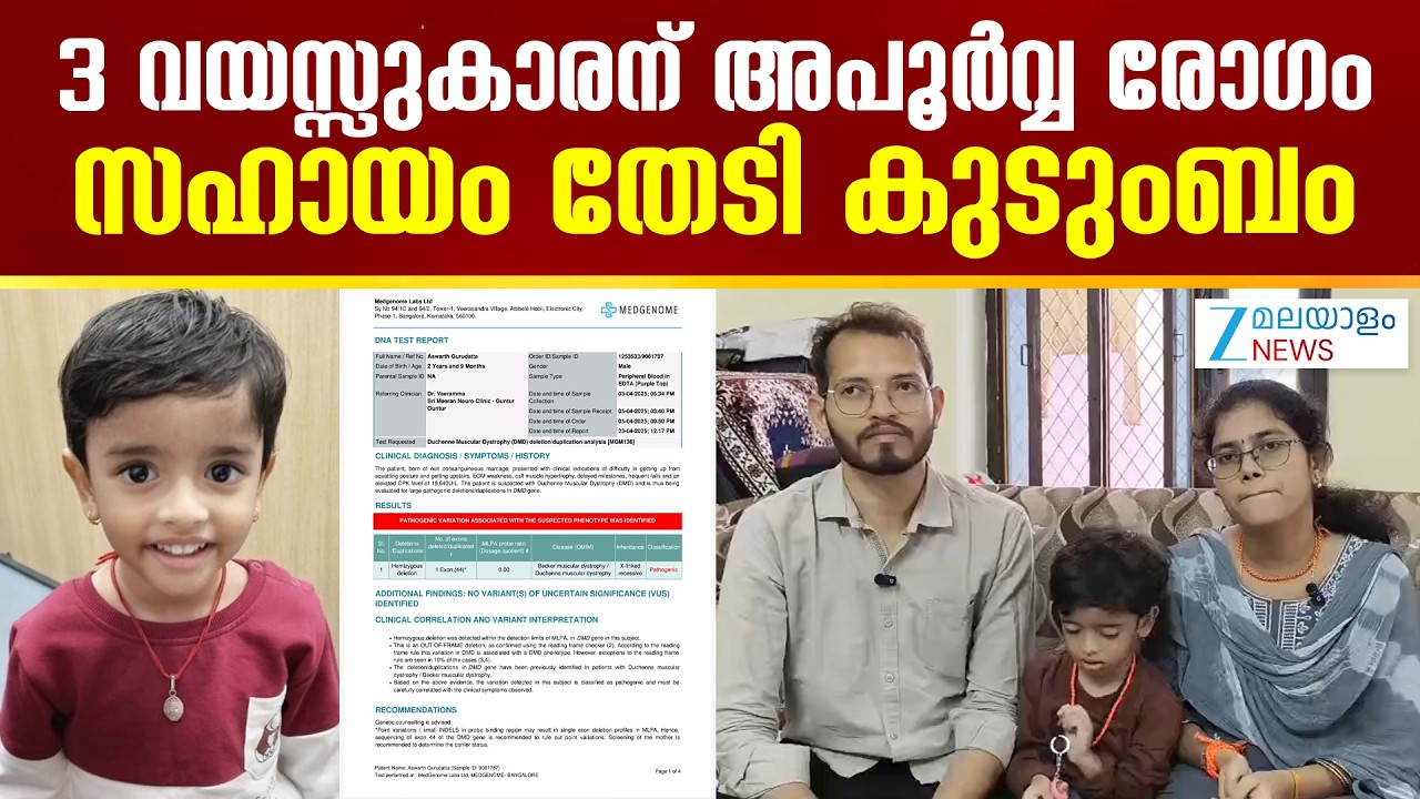 Kid Aswarth Gurudatta seeks Medical Help |  3 വയസ്സുകാരന് അപൂർവ്വ രോഗം; സഹായം തേടി കുടുംബം