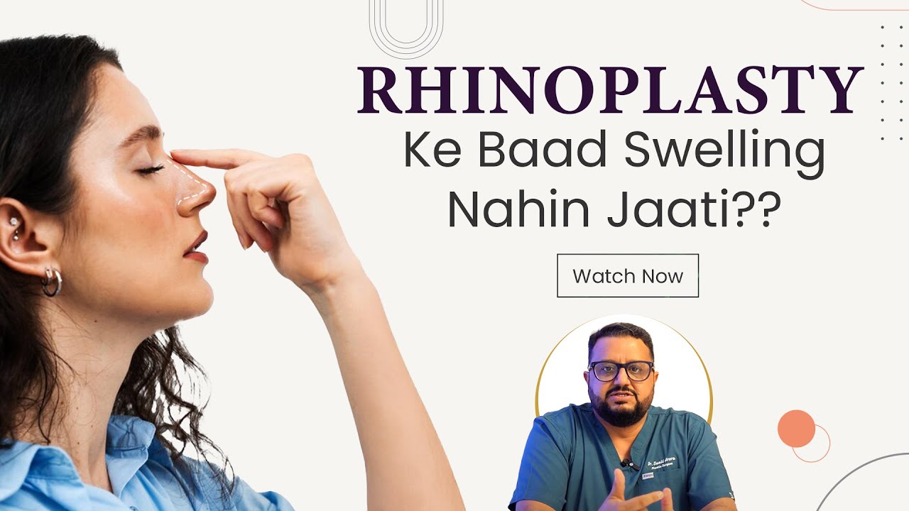 Rhinoplasty swelling कितने time में ठीक होती है? Recovery Guide!