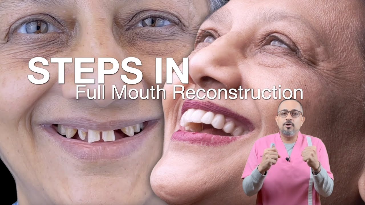 Complete Workflow of Full Mouth Rehabilitation