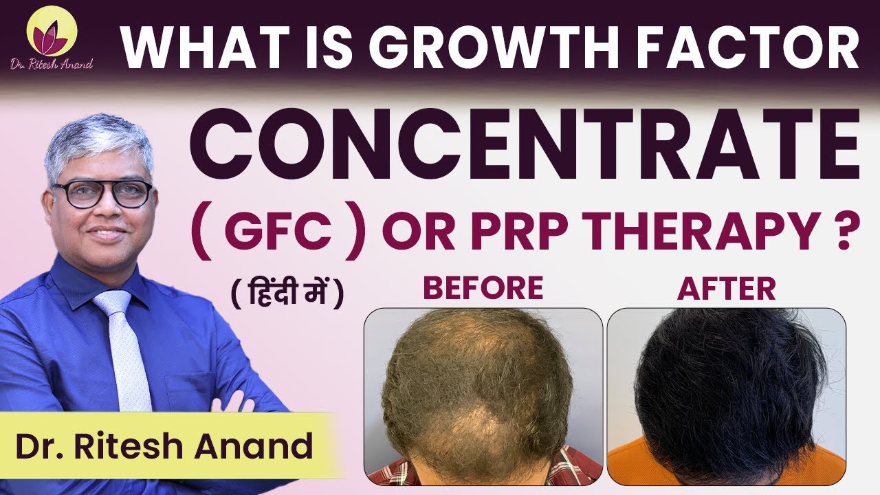 What is Growth Factor Concentrate (GFC) Therapy in Gurgaon ? Is GFC is Better Than PRP?