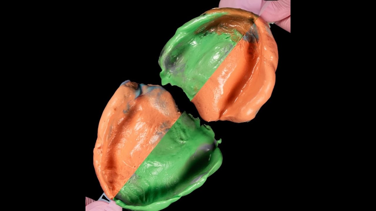 Final Impression techniques for complete denture construction