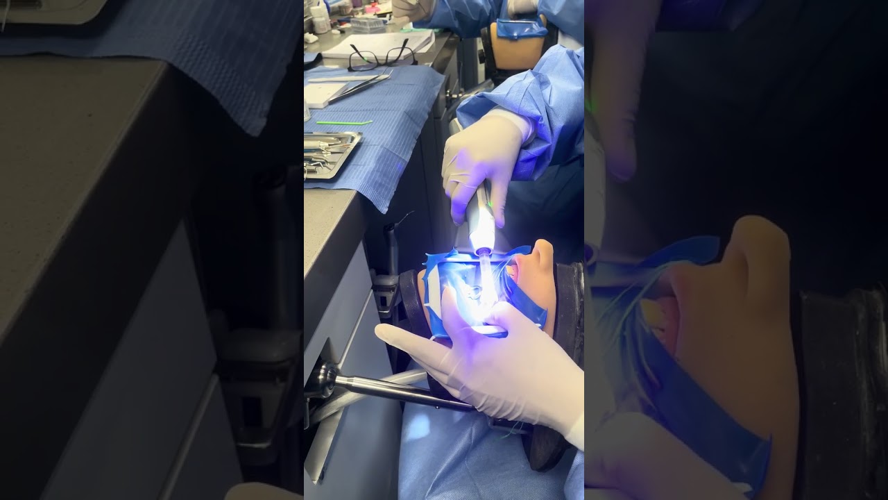 Simulación ionomero vitrimer 
