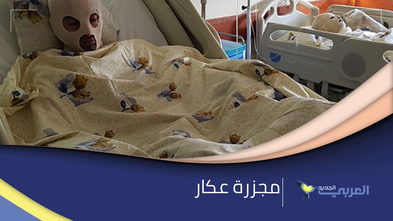 مجزرة عكار: 28 قتيلاً وعشرات الجرحى بانفجار صهريج وقود