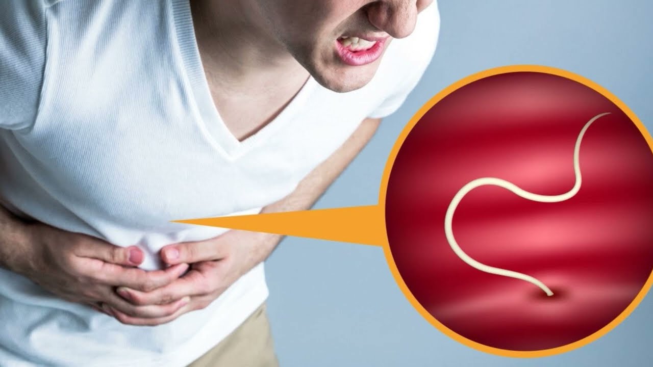 Паразит әлемі 