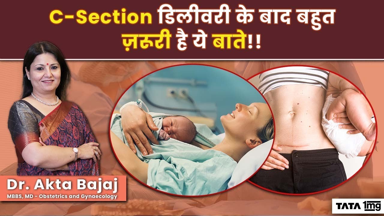 C-Section डिलीवरी के बाद कैसे रखे अपना ध्यान? | Care Tips After C-Section by Dr Akta Bajaj