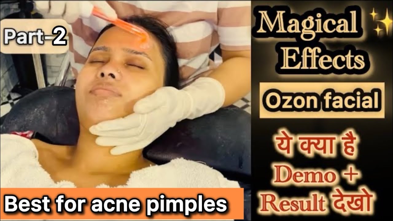 Effective Acne treatment 🔴 Part-2 || High frequency facial step by step | High frequency machine use