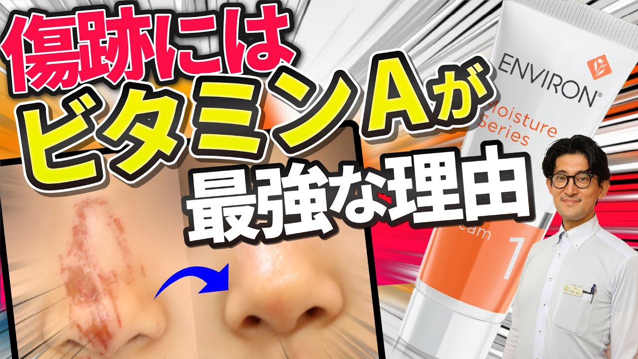 傷跡のケアにビタミンAが最強な理由を知っていますか！
