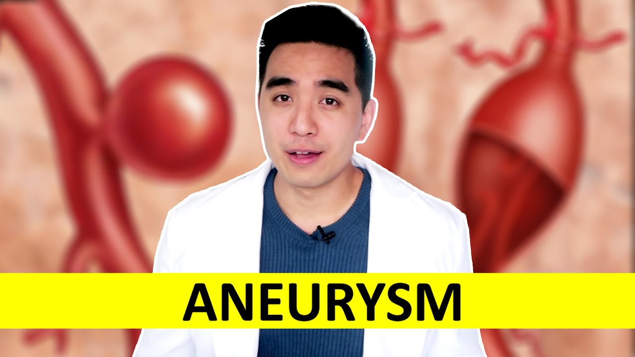 ANEURYSM - Paano ito iwasan? May gamot ba? Tumutubo ba sa isang araw?