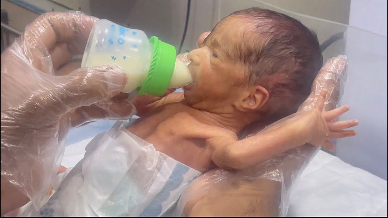 Feeding Premature 7-Month Born Tiny Baby 🍼👶🤍 | Gentle Preemie Care  #PrematureBaby #PreemieStrong