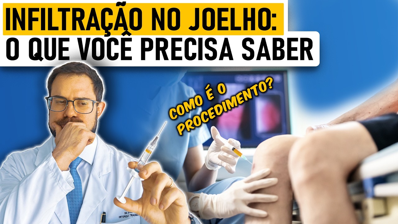Orientações Pré e Pós Infiltração no Joelho e Como é o Procedimento [Aulão c/ Especialista]
