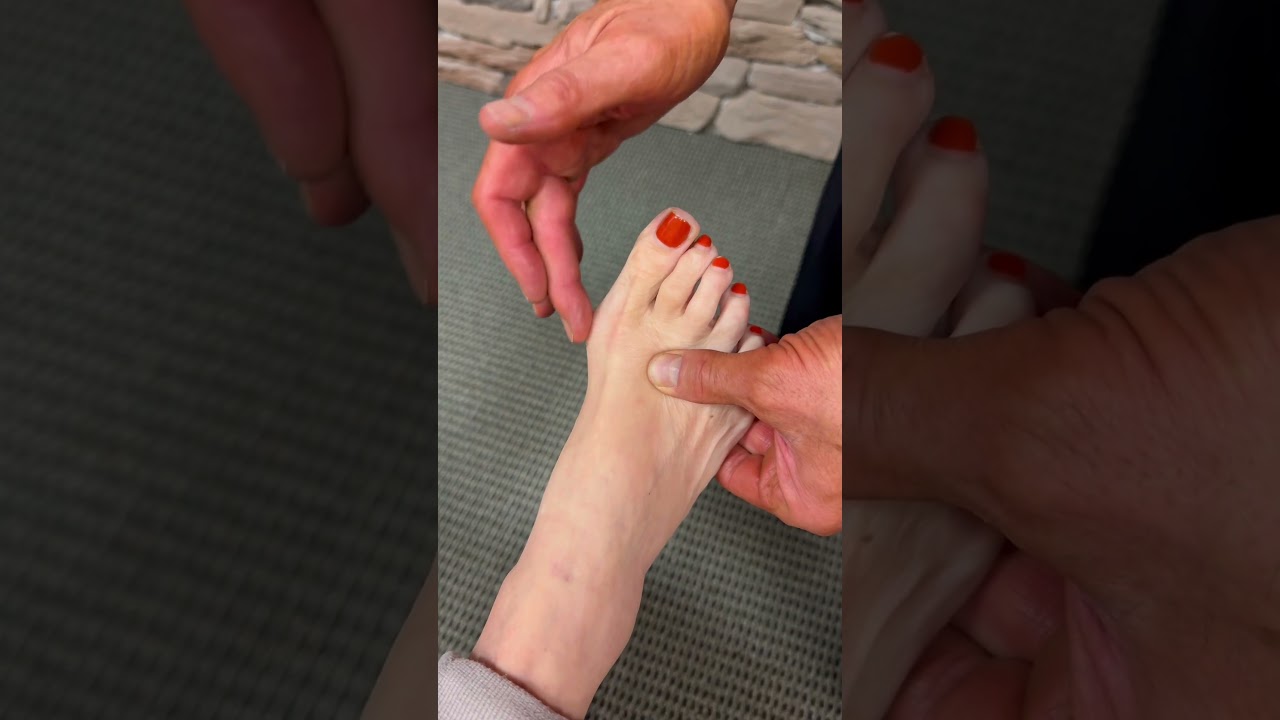 Коррекция БОЛЬШОЙ косточки! #хиропрактик#asmrvideo#asmrcommunity#adjustment#footpain#adjustment#t...