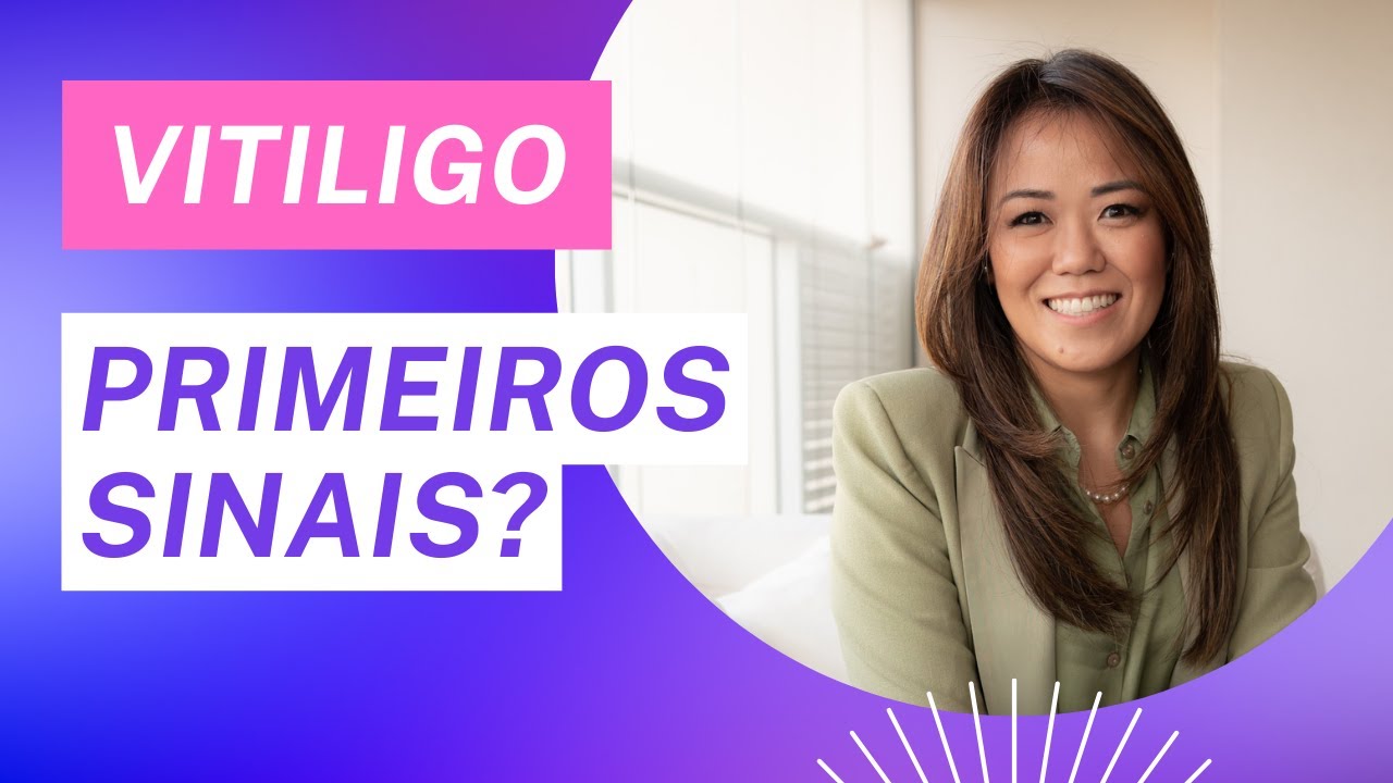 COMO SABER SE VOCÊ TEM VITILIGO - DERMATO DRA JULIANA