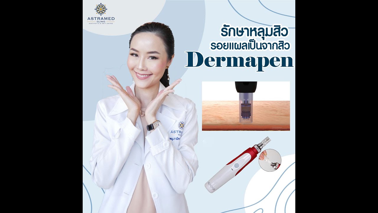 รักษาหลุมสิว ด้วย Dermapen