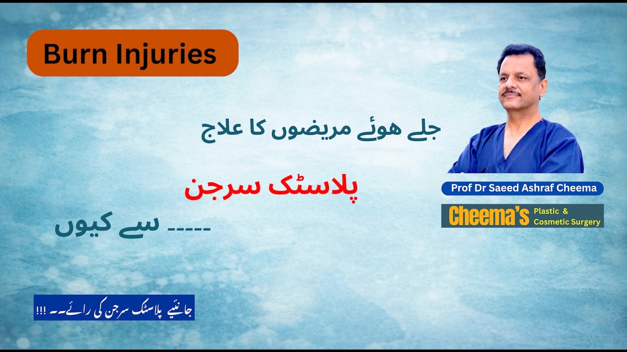 Burns & Burn Awareness جلے ھوئے مریضوں کا علاج پلاسٹک سرجن ھی سے کیوں