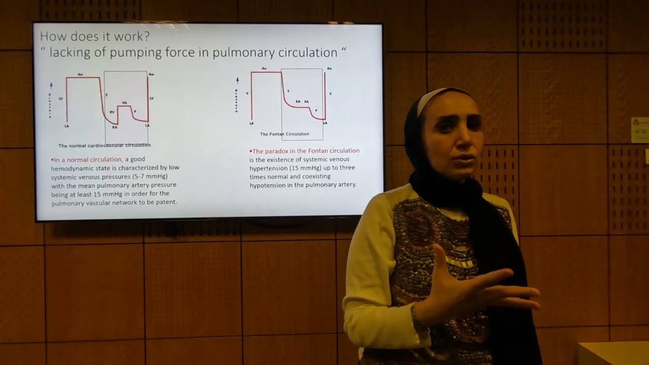 Fontan Palliation - Soha Romeih