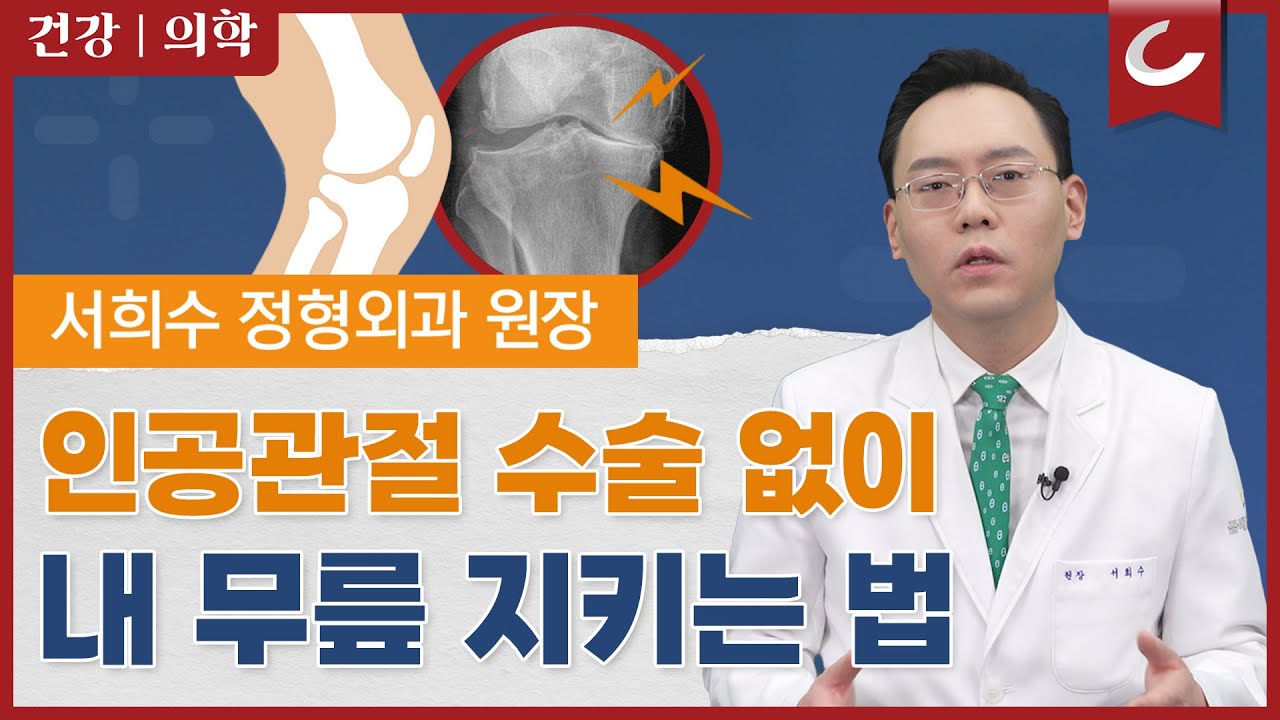 무릎 퇴행성관절염, 인공관절 수술 없이 내 무릎을 지키는 방법 @제애정형외과 (#퇴행성관절염 #퇴행성관절염치료 #무릎관절염 #무릎연골재생 #무릎통증 #무릎퇴행성관절염 #무릎명의)