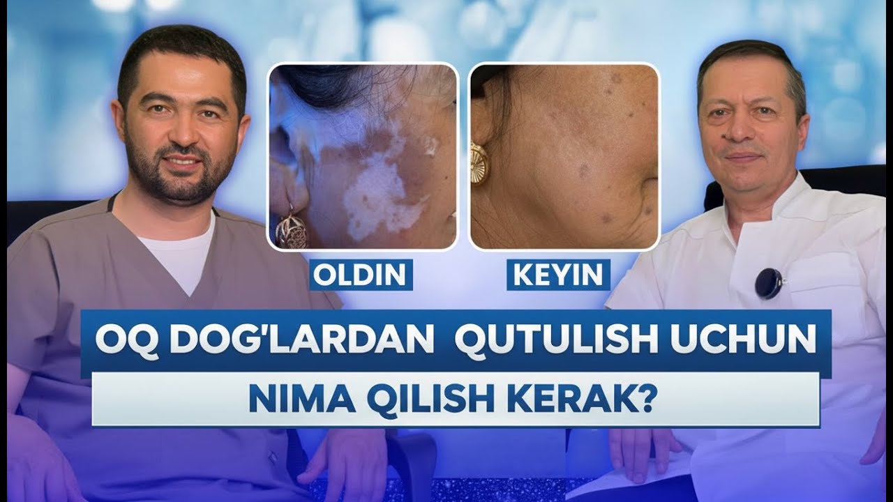 OQ DOG' KASALLIGI DAVOSI! VITILIGONI DAVOLASHDA PSIXOLOGIK VA IKKILAMCHI OMILLAR TA'SIRI