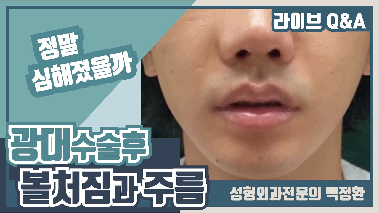 수술 후 볼처짐이 심해졌어요... 볼처짐과 주름에 대한 오해