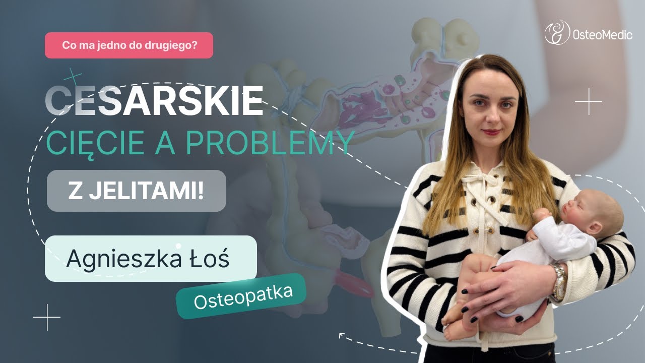 ⚠️ Cesarskie cięcie może zmienić mikrobiotę dziecka! Sprawdź, jak to działa! 😱