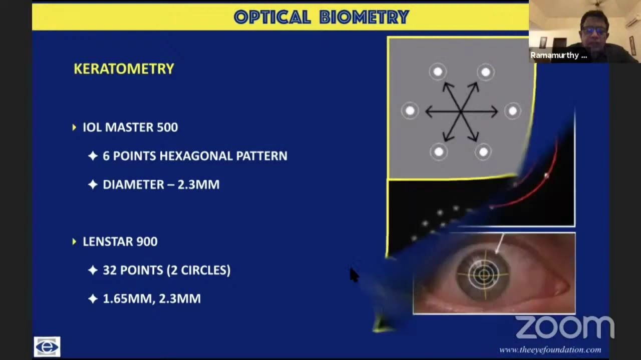 Dr Ramamurthy D - Optical Biometry - Clinical Imaging in Glaucoma & Cataract AIOS ARC