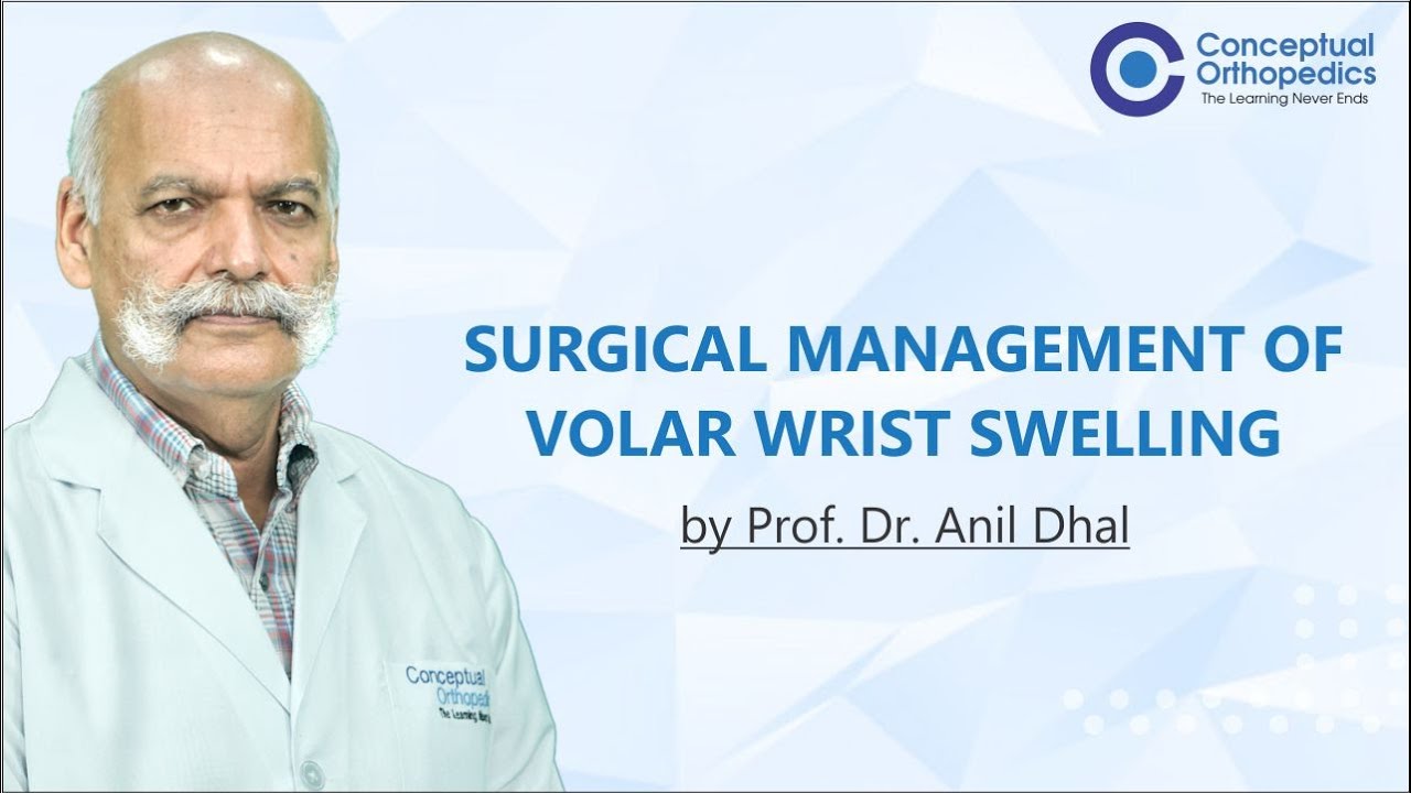 Surgical Management of Volar wrist swelling by Prof. Dr.Anil Dhal @ConceptualOrthopedics