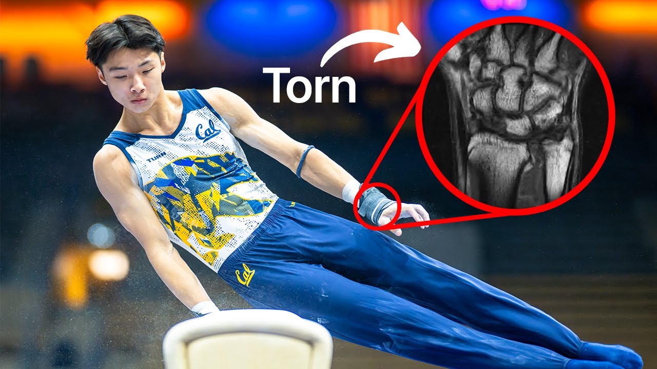 My Hardest Competition EVER with a Broken Thumb