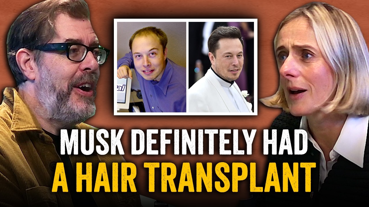 Where Are All The Bald Celebrities?