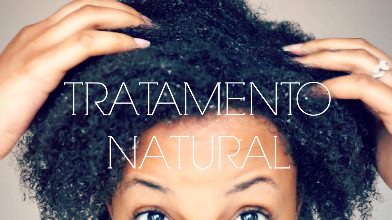 TRATAMENTO NATURAL ANTI CASPA ♡ |  Joyce Carter