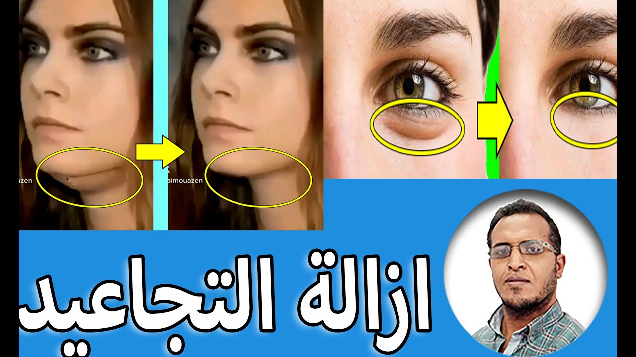 فوتوشوب_ازالة التجاعيد
