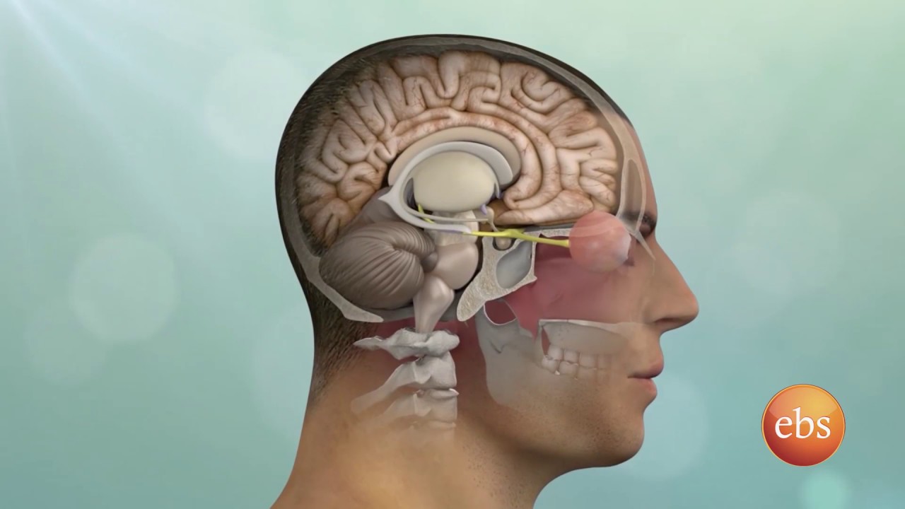 New life Season 1 Ep 131:  Brain Tumor: Symptoms, Surgery, Types, and Treatment