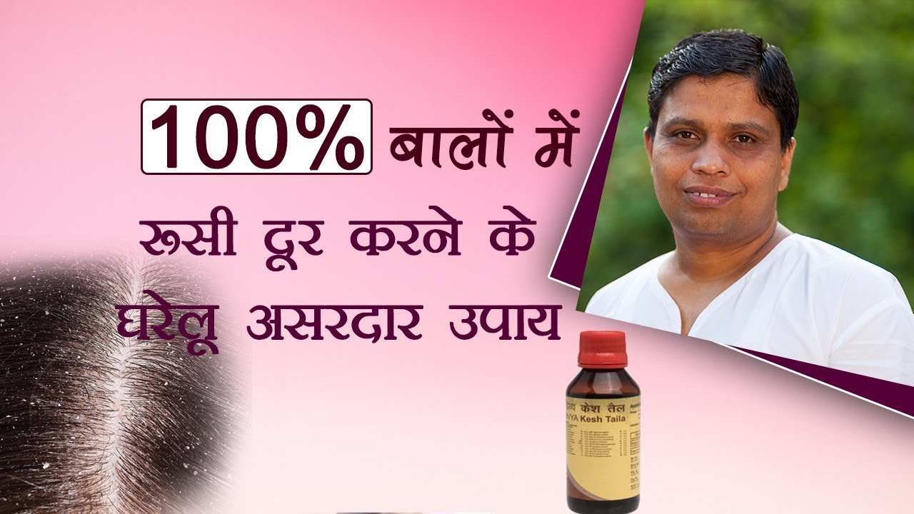 100% बालों में रुसी दूर करने के घरेलू उपचार | Acharya Balkrishna